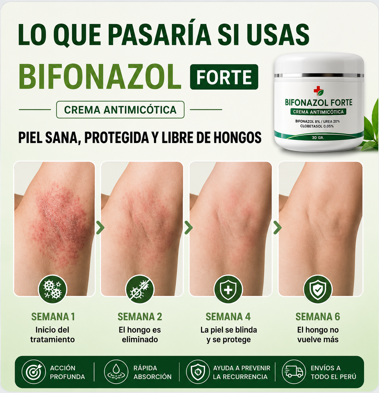 Bifonazol Forte 3 EN 1 | Crema Intensiva Contra Hongos y Tiña