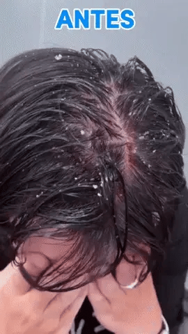 SHAMPOO DERMATOLOGICO 5 EN 1 ANXIOR